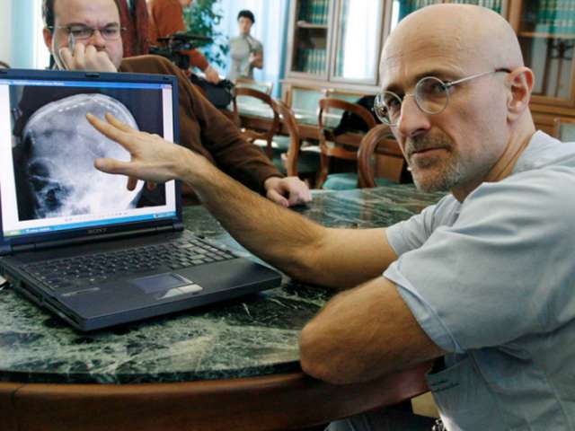 Italian-Chinese Medical Team to Perform First Head Transplant